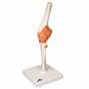 UK 3B Functional Elbow Joint