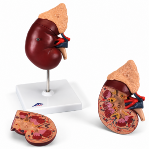 UK 3B Kidney Stone Model
