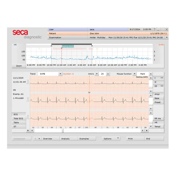 4900055001 seca holter software