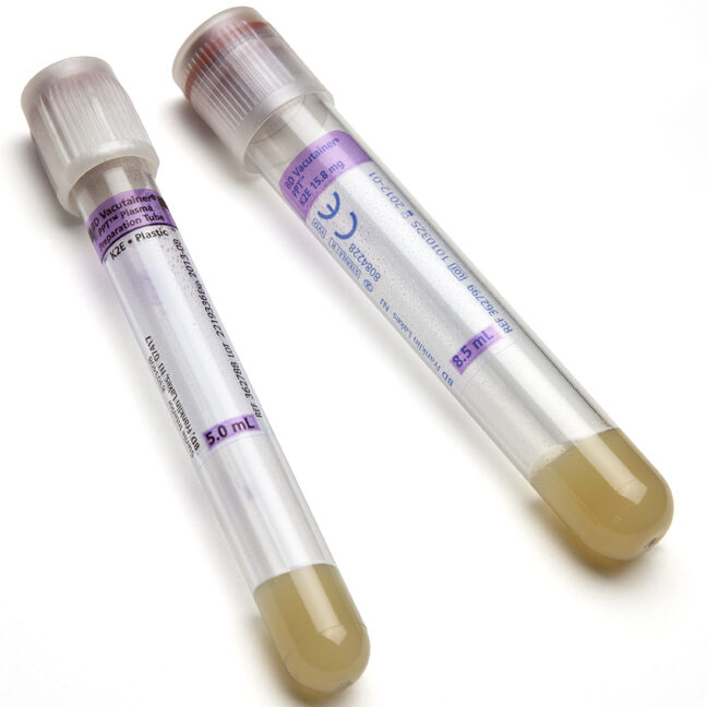 BD Vacutainer PST Plastic Tube with Light Green Hemogard Cap (8ml) - Pack of 100