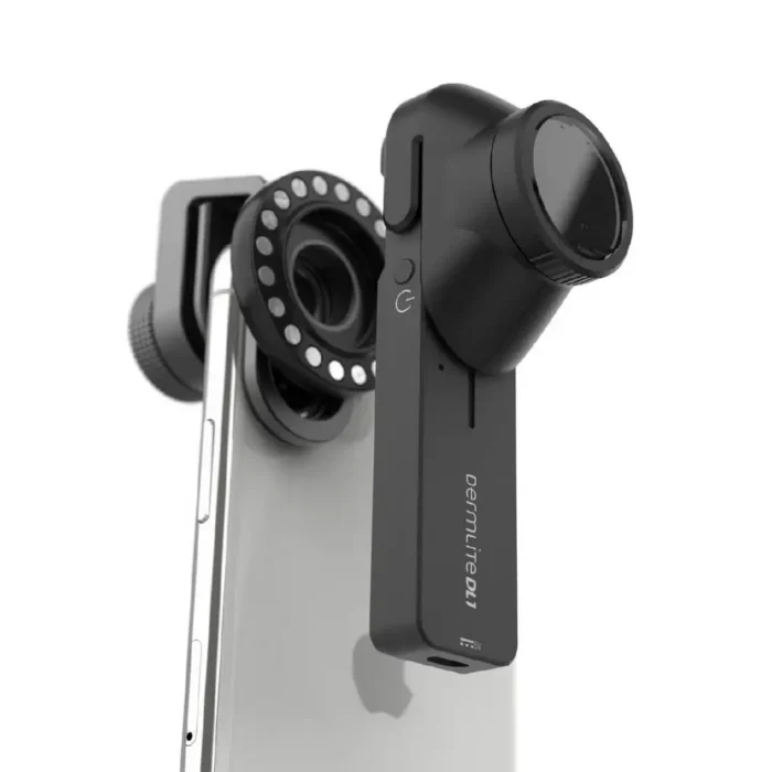 DermLite DL1 on smartphone