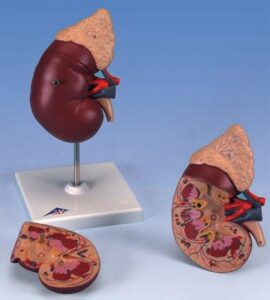 UK 3B Kidney Stone Model