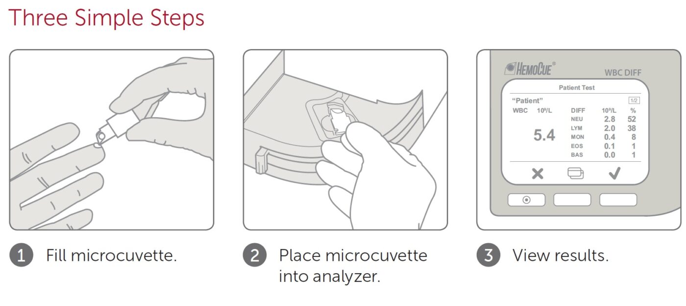 HemoCue WBC Diff Microcuvettes 113503 2 x 25 Single HCE