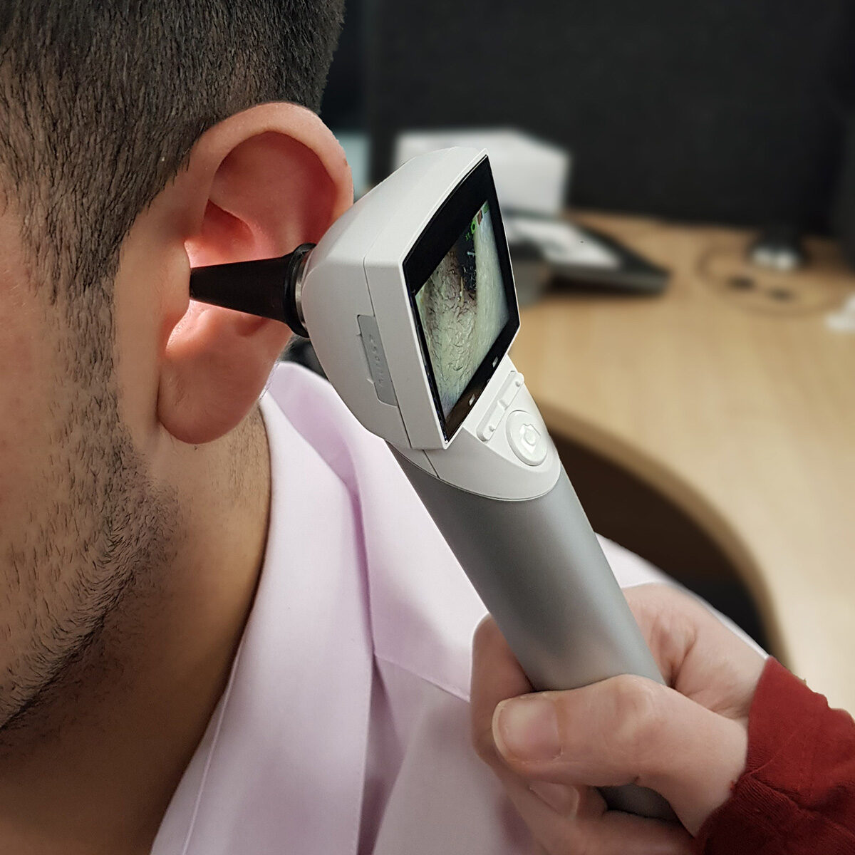 iO1 OTO Sync Vision Digital Video Otoscope iO1 OTO Elite HCE