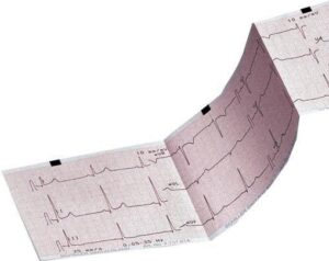 CLEARANCE ECG Paper Schiller – Part number 2.157038 : Single pack - (25 Available)