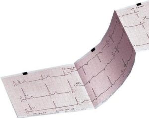 CLEARANCE ECG Paper Schiller – Part number 2157044 : Single pack - (30 Available)