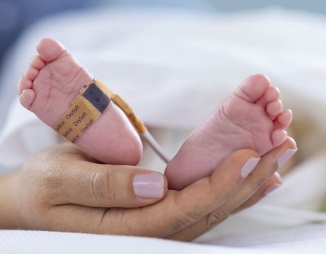 Nellcor Sp02 Sensor Neo/Adult Oxysoftn (BOX OF 24) | HCE